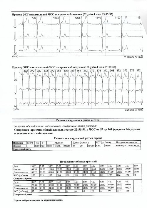 Бланк экг образец для распечатки