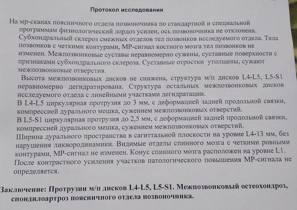 Остеохондроз поясничного отдела позвоночника карта вызова