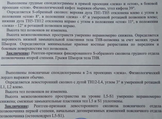 Ст 66 болезни. Сколиоз заключение рентген. Заключение сколиоз 2 степени. Степень ротации тел позвонков. Ротация тел позвонков рентген.